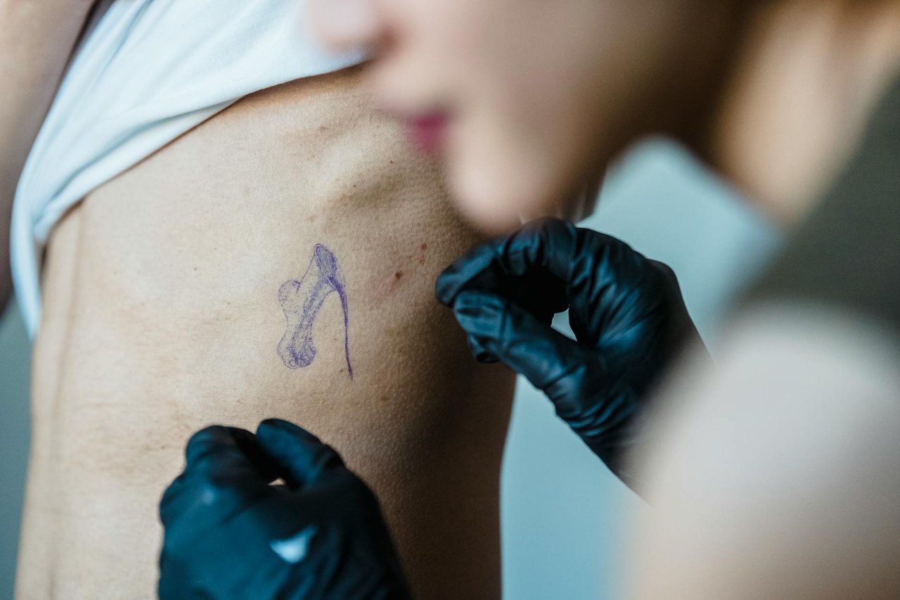 Tattoo Allergies: Signs, Causes & What to Do Next